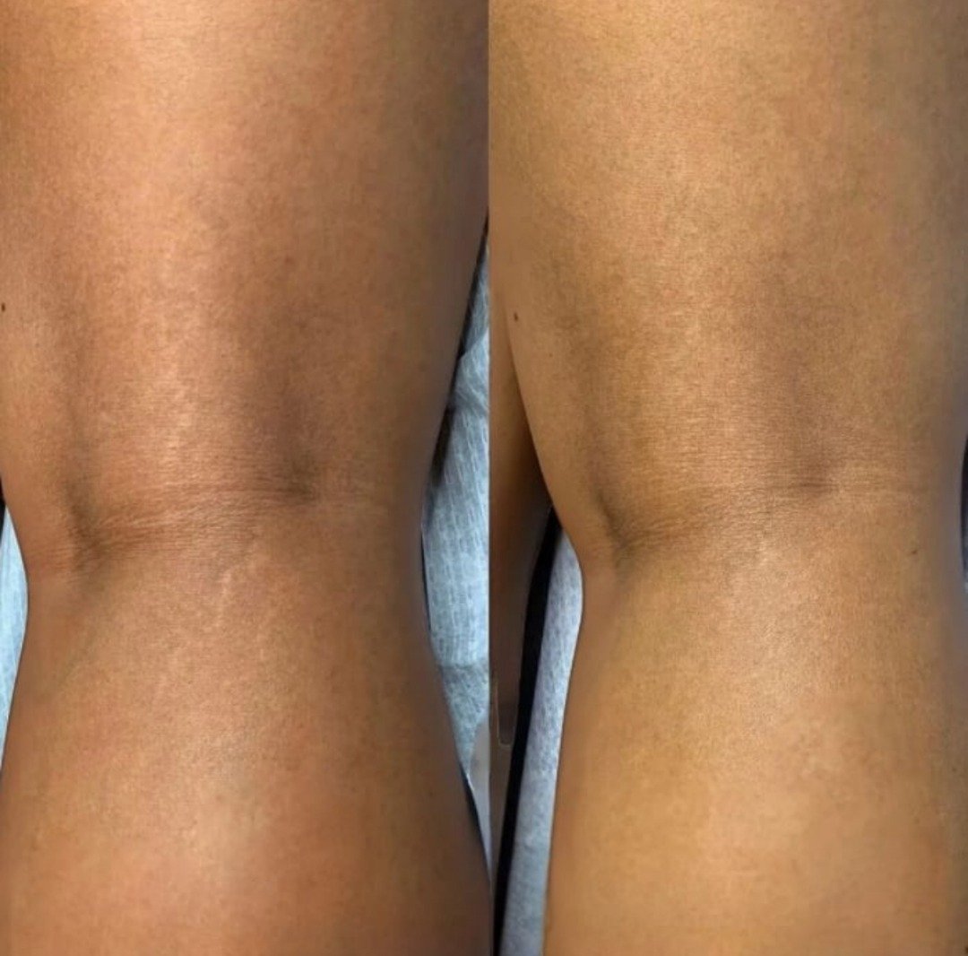 WhatsApp Image 2025 11 18 at 12.04.51 AM